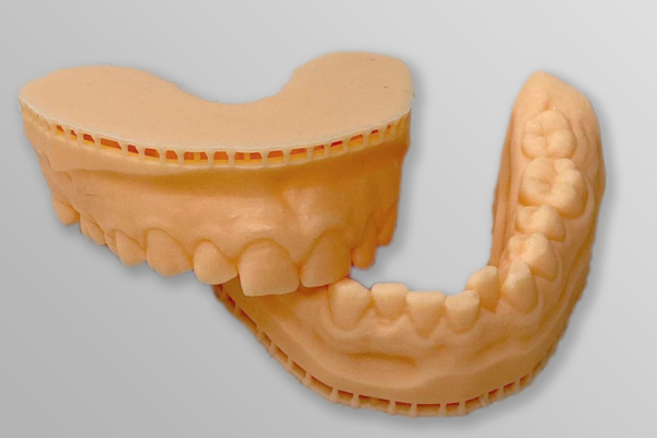 Изготовление стоматологической челюсти по технологии SLA